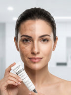 Crème antitache Kelvaderm